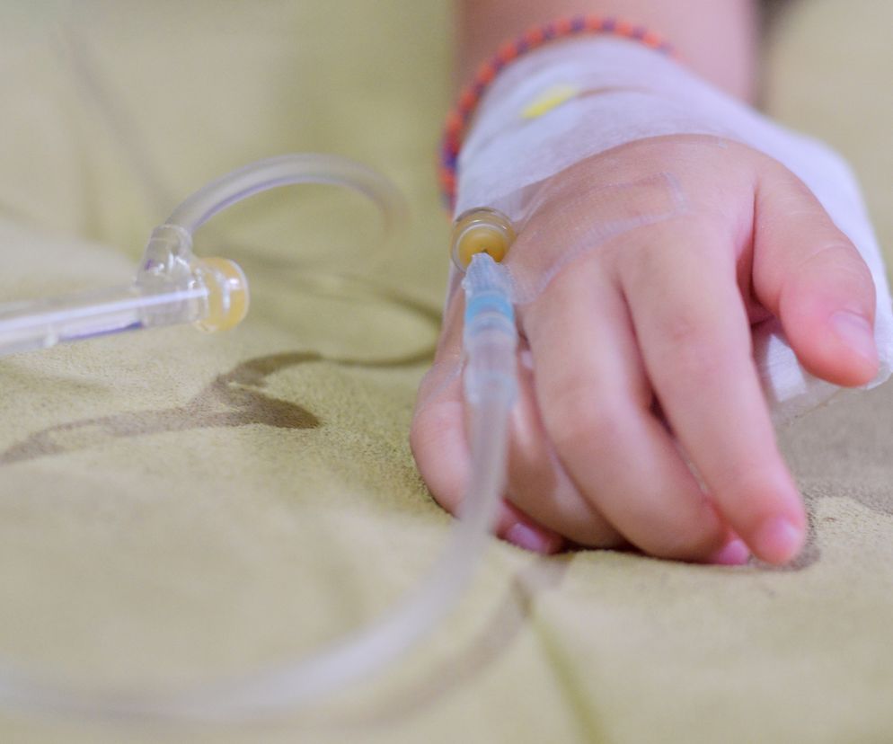 Z mózgu rocznej dziewczynki usunięto jej bliźniaka. Zdjęcia nie dla wrażliwych 