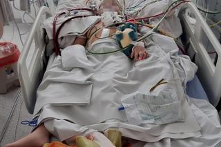 Gdańsk. Życie 6-letniego Aleksa uratowane. Inni lekarze nie dawali mu szans