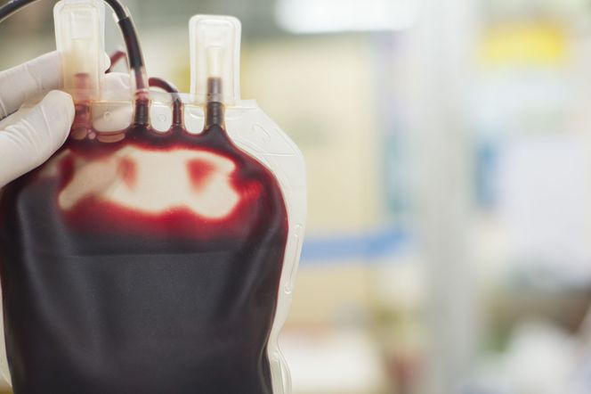 Hemodylucja: na czym polega? Zalety i zagrożenia związane z zabiegiem
