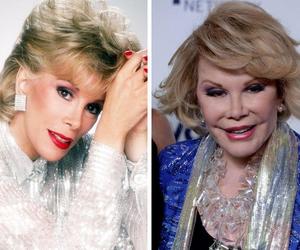 Joan Rivers - PRZED i PO