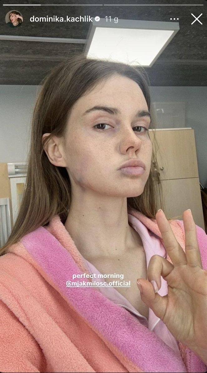 M jak miłość. Dominika Kachlik na planie