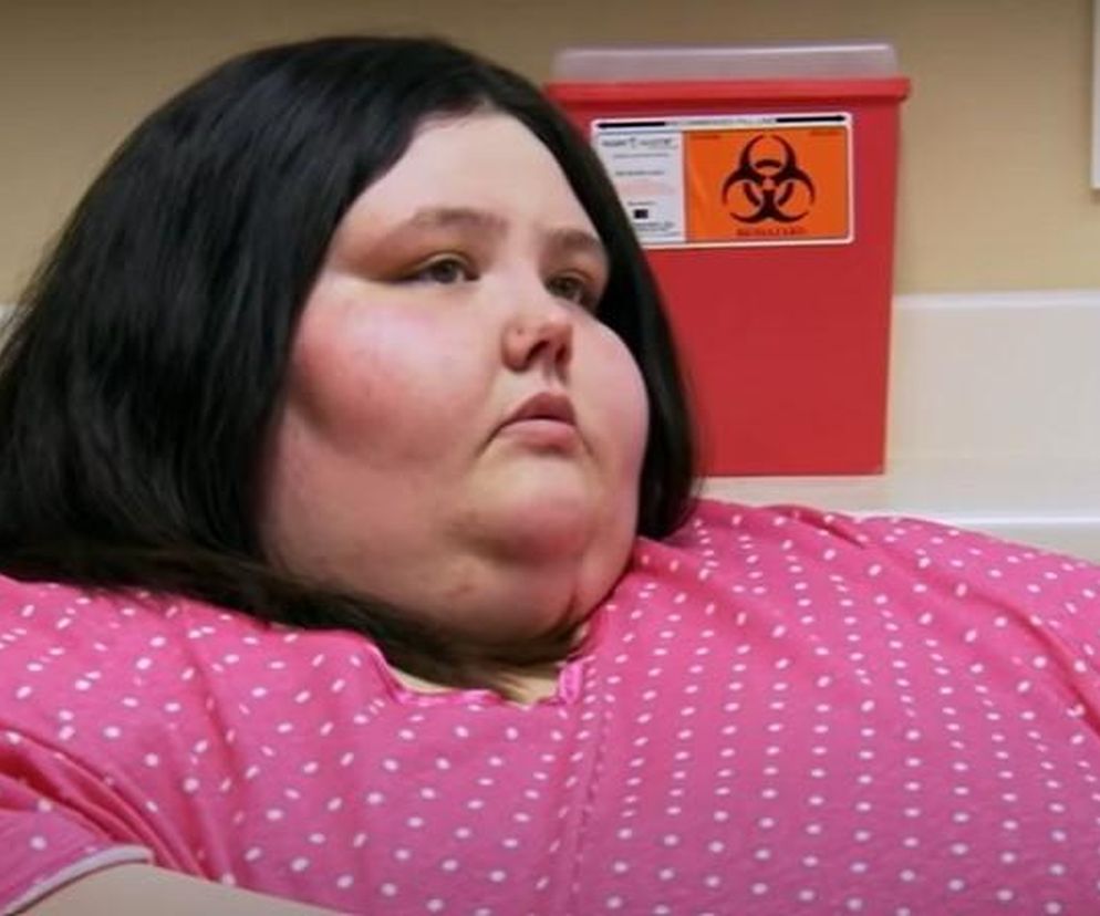 Czuła się więźniem swojego ciała. Schudła ponad 200 kilogramów i tak teraz wygląda