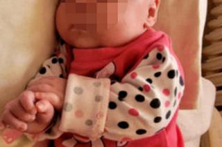 Siostry rozdzielone tuż po porodzie. Lekarze nie mieli innego wyjścia. Rodzice dziewczynek nie chcą się poddać [ZDJĘCIA]