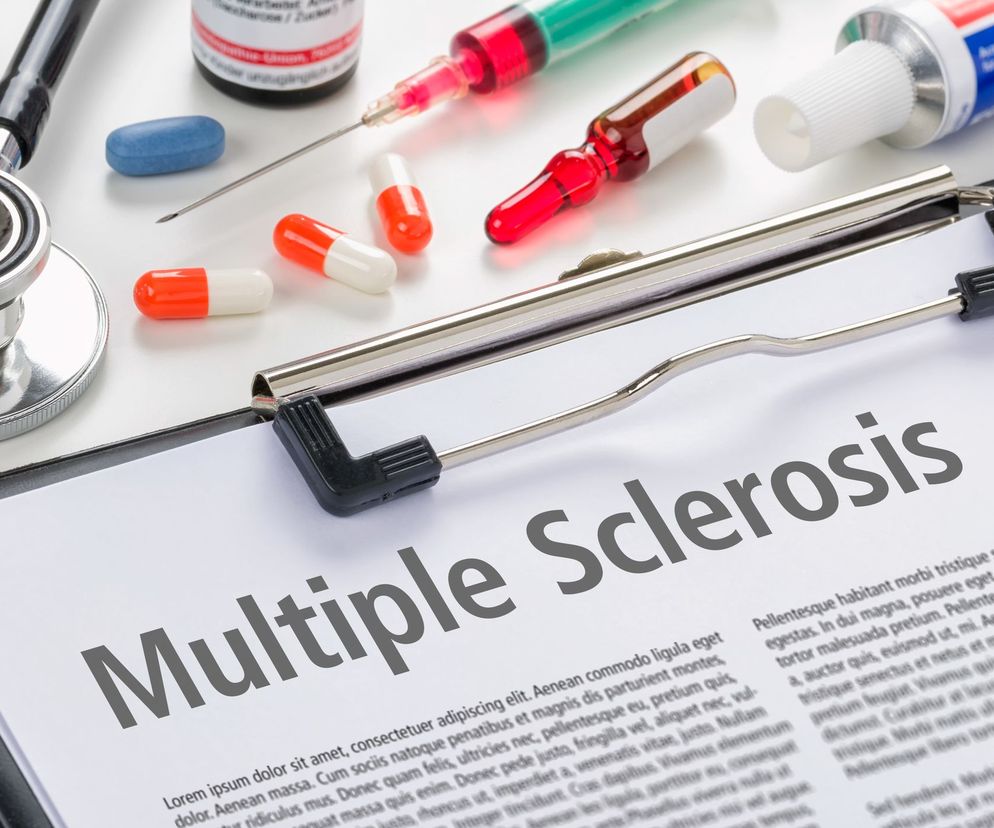Leczenie stwardnienia rozsianego (SM,  sclerosis multiplex ) zależy od postaci choroby i stanu chorego.