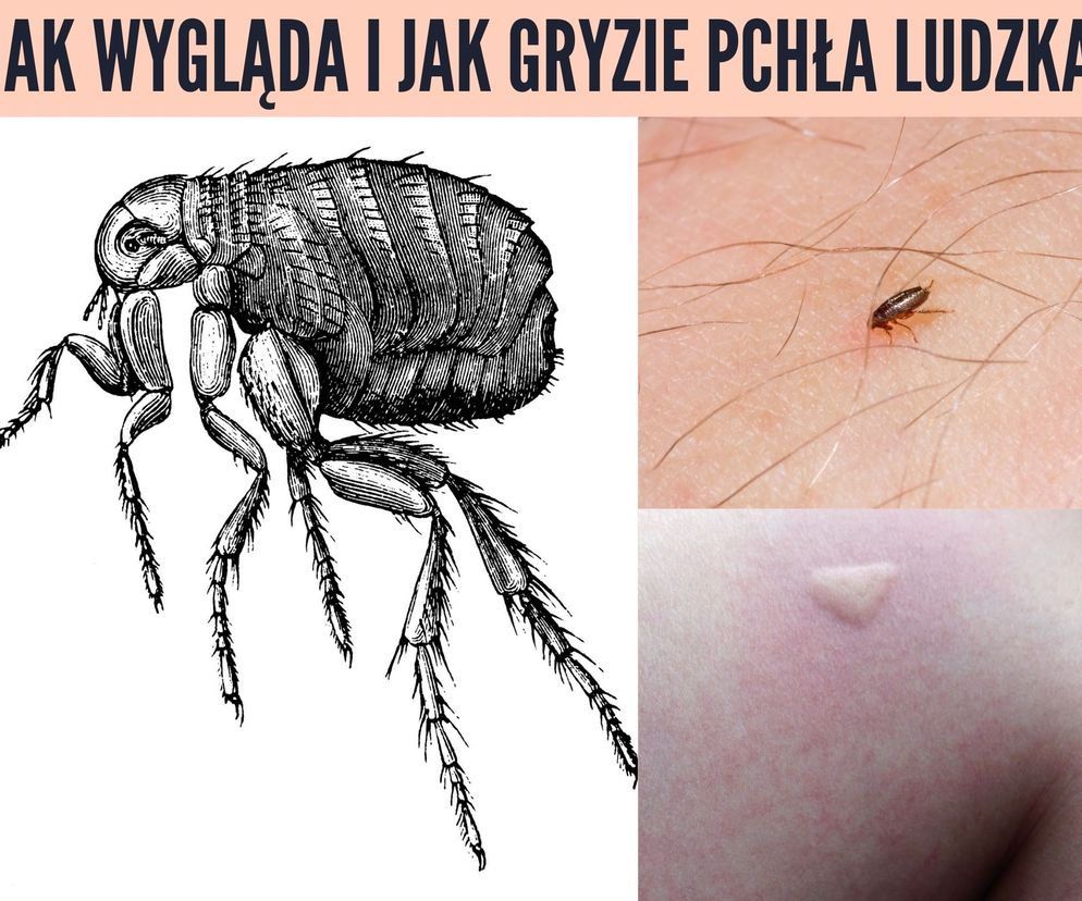 Jak wygląda i jak gryzie pchła ludzka