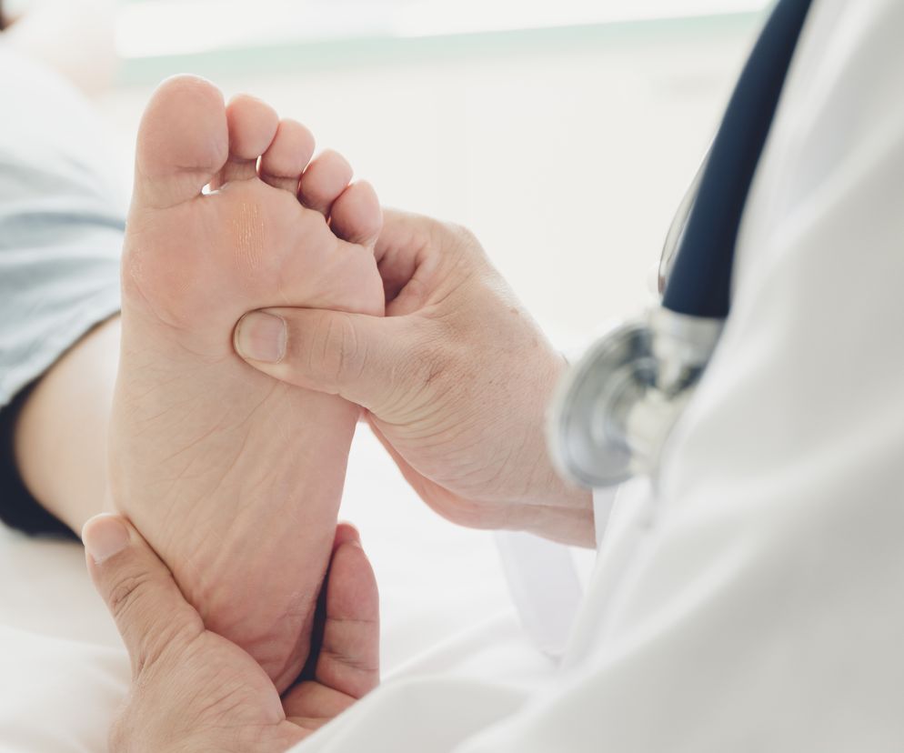 Lekarz opisał przypadek rzadkiego schorzenia. Cierpi na to zaledwie tysiąc Polaków