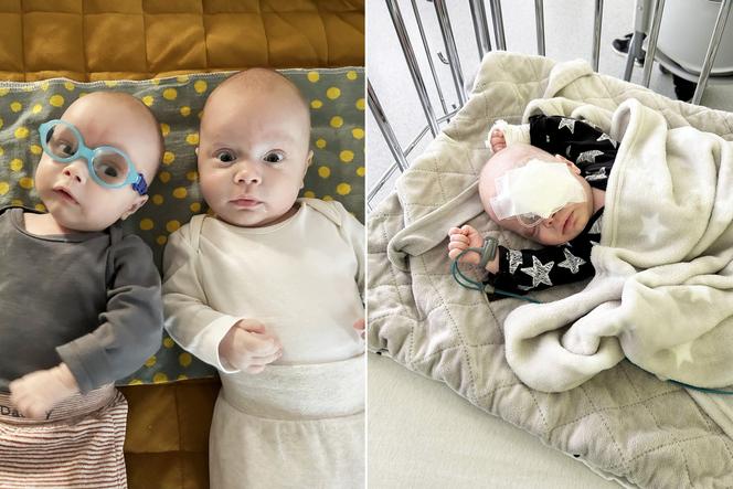 Apel o pomoc dla bliźniaków