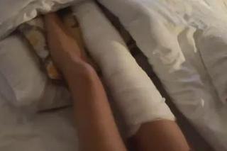 Gips Rozenek po wypadku żyje własnym życiem 