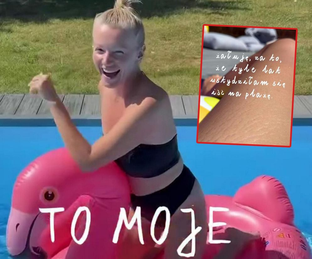 Dorota Szelągowska nie wstydzi się rozstępów
