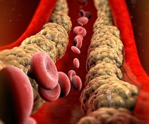 Wystarczy jeden zastrzyk, a zły cholesterol zniknie. Obiecujące badania