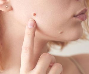 Masz taki pieprzyk na twarzy? To on skrywa ważną prawdę o Twoim związku. Znaczenie pieprzyków i znamion na ciele