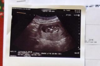 Mogli stracić dziecko przez błąd lekarki?