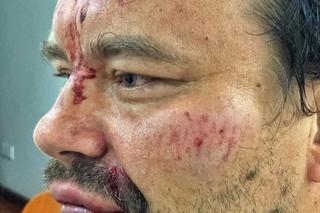 Pobili dziennikarza GW