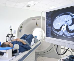 Badanie fMRI, czyli funkcjonalny rezonans magnetyczny. Na czym polega badanie aktywności mózgu?