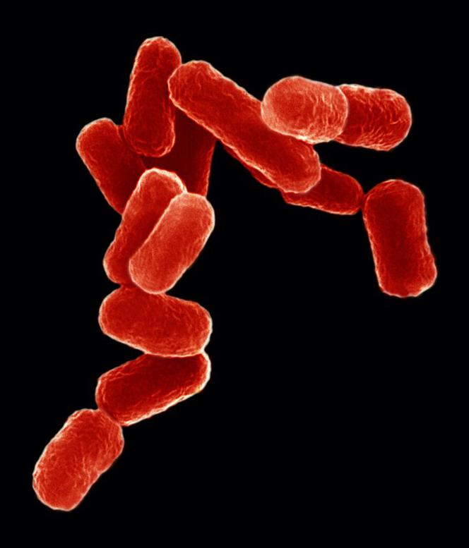 Escherichia coli - tej bakterii nie możesz lekceważyć!