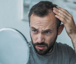 Zakola to nie tylko męski problem. Jeden nawyk może pobudzić wzrost nowych włosów