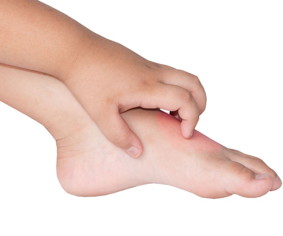 Swędzenie skóry może być objawem wielu chorób, dlatego zawsze należy skonsultować je z lekarzem. Przeważnie jednak przyczyną takiego stanu jest sucha skóra i jeśli poza suchością skóry nie występują inne zmiany - skoncentrować się na natłuszczeniu jej.