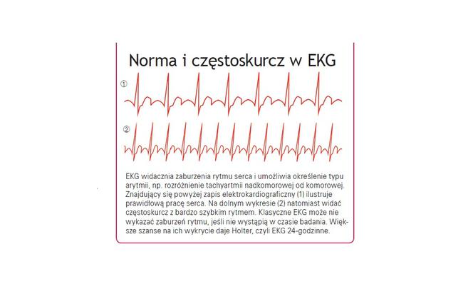 Norma i częstokurcz w EKG