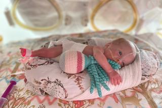 Maleńka Marta urodziła się w Rudzie Śląskiej. Dziewczynka po porodzie ważyła 390 gramów! [ZDJĘCIA]