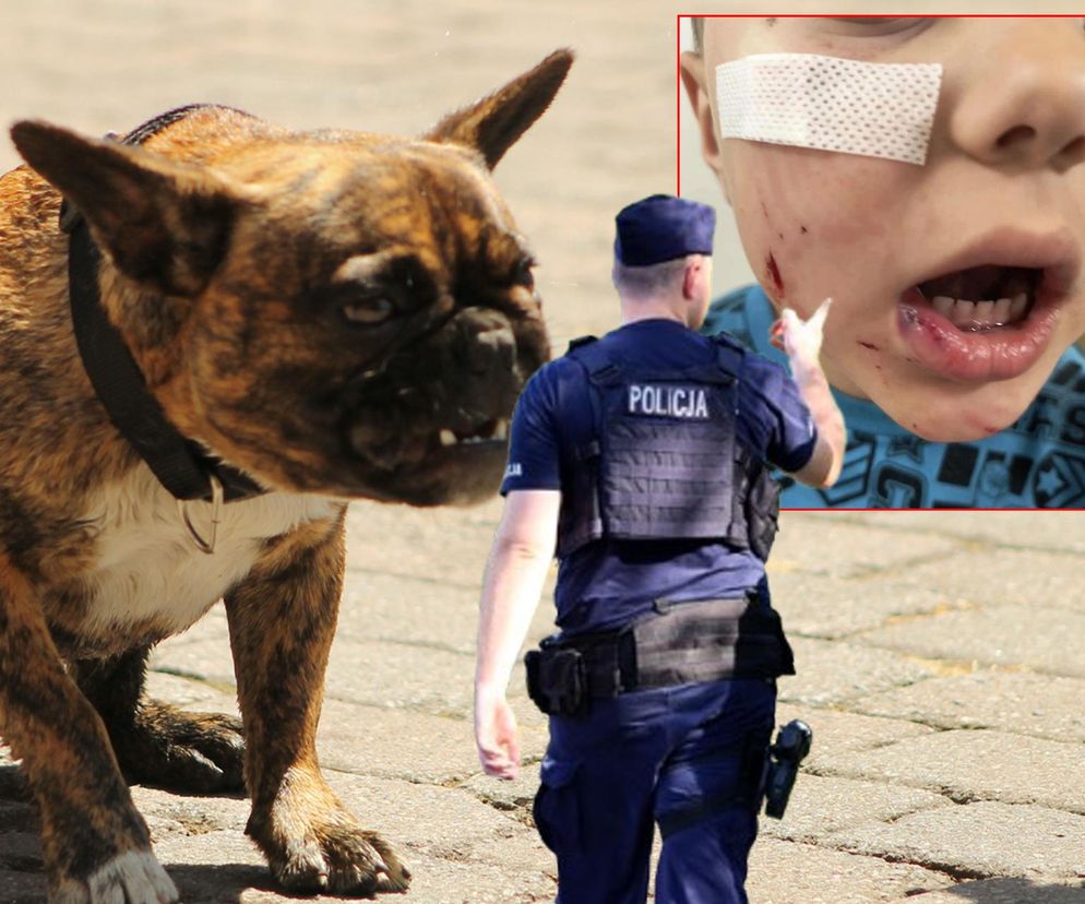 Pies pogryzł 4-letniego Frania. Chłopczyk w szpitalu, policja szuka właściciela
