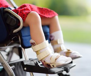 Postępujące kostniejące zapalenie mięśni (fibrodysplazja, FOP)