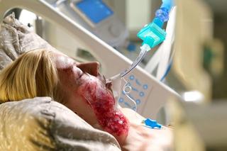  M jak miłość, odcinek 1767: Jagoda z bliznami na twarzy do końca życia? Tadeusz usłyszy od lekarza wstrząsającą diagnozę 