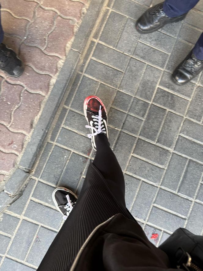 Dziennikarka „Super Expressu” oblana farbą i wyrzucona z pikiety antyaborcjonistów. „Wynocha z mojego zgromadzenia!”