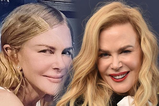  Nicole Kidman ma nową twarz! Nie uwierzysz, gdy ją zobaczysz