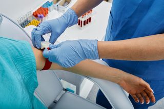 Nadmiar dobrego cholesterolu może prowadzić do demencji. Zagrożona zwłaszcza jedna grupa 