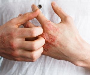 Pacjenci z ciężkim AZS na krawędzi