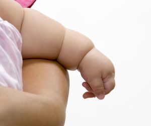 Otyłość i geny. Co to jest zespół Bardeta-Biedla?  