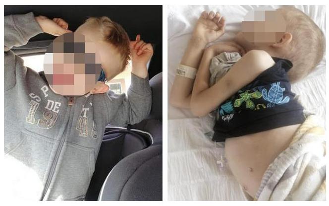 Krew potrzebna natychmiast! Trwa walka o życie małego Szymonka spod Makowa Mazowieckiego [ZDJĘCIA]