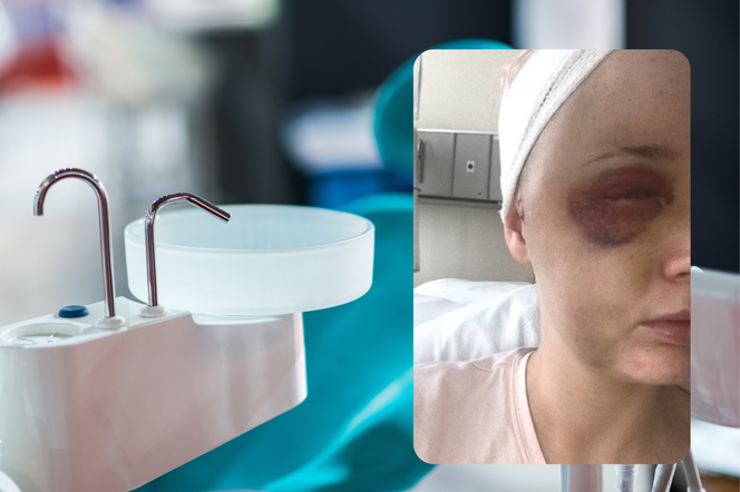 29-latkę bolał ząb, okazało się, że to objaw guza mózgu. Byłam gotowa zaplanować swój pogrzeb