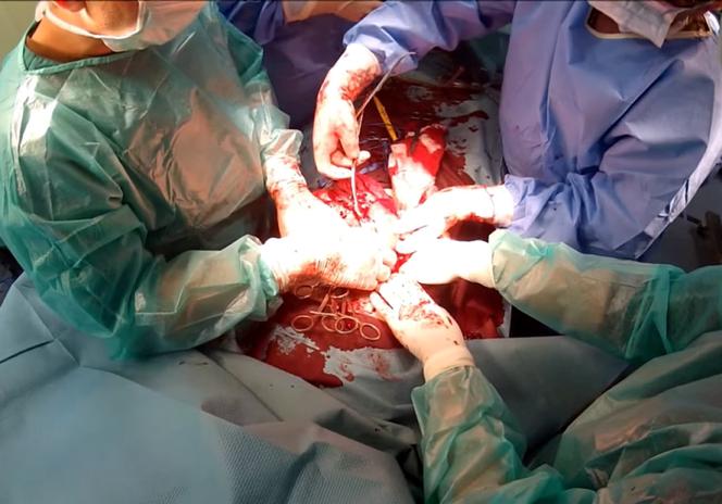 żołnierze Afganistan szpital Szaserów