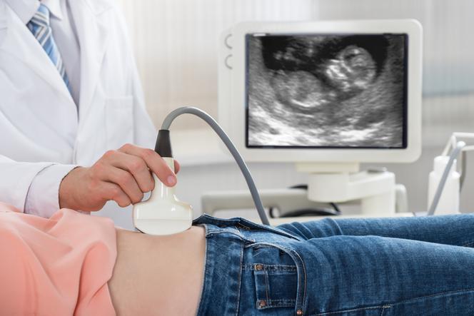 Przezierność karkowa: ważny parametr badania USG w ciąży