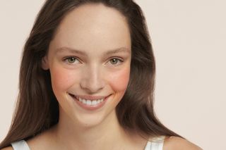 Nowoczesna pielęgnacja dla cery naczynkowej