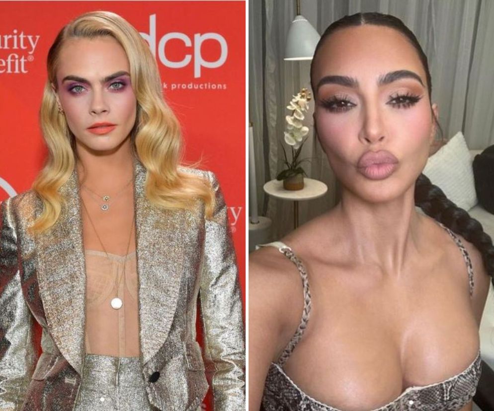 Z łuszczycą zmaga się m.in. Cara Delevingne i Kim Kardashian