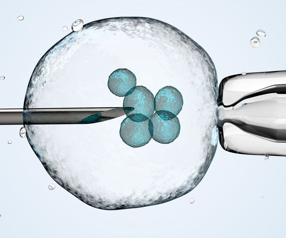 Mikroskopijny obraz zarodków in vitro. Widoczna jest probówka z igłą do zapłodnienia in vitro oraz komórka jajowa i rozwijające się zarodki. Dowiedz się więcej o refundacji in vitro na portalu Poradnik Zdrowie.