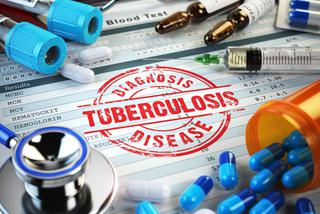Próba tuberkulinowa - badanie diagnozujące gruźlicę