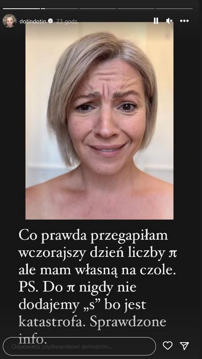 Szelągowska pokazała zmarszczki nie zgadniesz do czego je porównała.