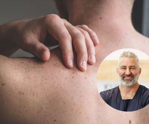 Dr Pawlikowski: Czerniak to mistrz kamuflażu