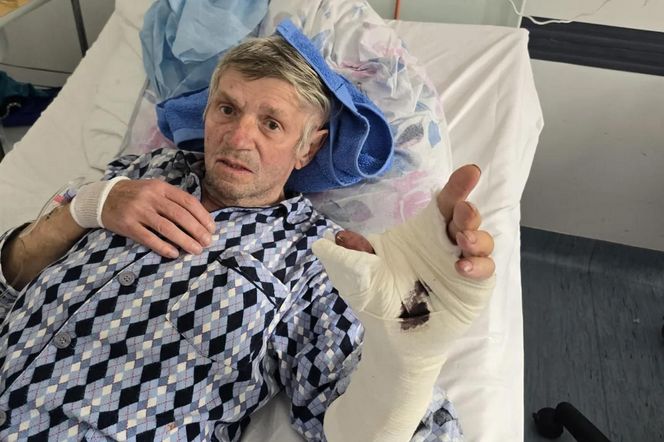 "Palec czy papierosy?" Emeryt podjął dramatyczną decyzję. Dziś ma i kciuka i nowe życie