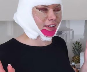 Julia Von Stein po operacji 