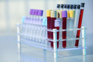 Badanie biochemiczne krwi (biochemia krwi): normy i interpretacja 