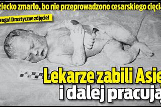 Mazowieckie. Lekarze zabili naszą Asię i dalej pracują! DRASTYCZNE zdjęcia!