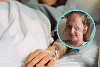 Guzek na oku był objawem rzadkiego nowotworu. Lekarze mówili, że po usunięciu gałki ocznej wyzdrowieje