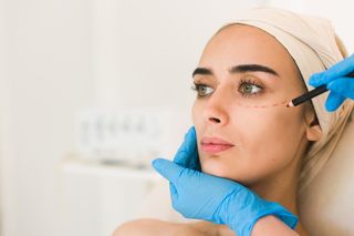 Blepharoplastyka: na czym polega zabieg korekcji powiek? 