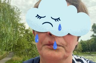 Kobieta pobita przez staruszka, bo zwróciła mu uwagę. Przewrócił mnie na chodnik i okładał parasolką, potem uderzył pięścią w twarz