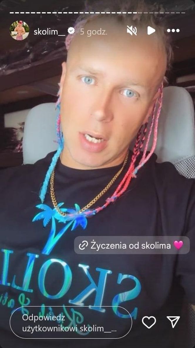 Skolim przeszedł niezłą metamorfozę. Szok, jak teraz wygląda