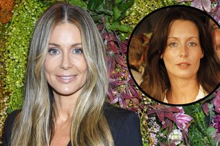 Lekarka wzięła pod lupę twarz Małgorzaty Rozenek-Majdan. Blefaroplastyka powiek, botox...